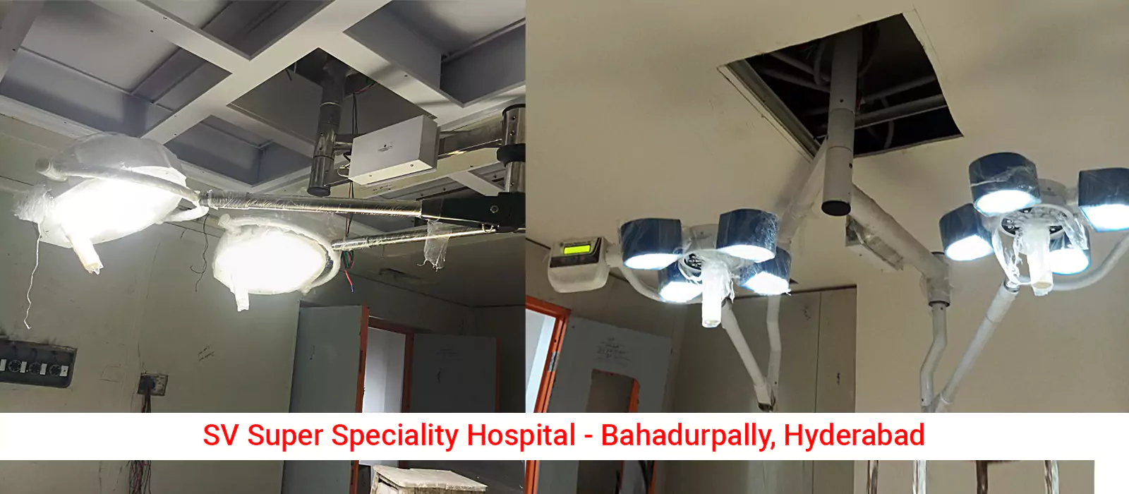 6773926eb0ef6_668949eccbf74-03-sv-super-speciality-hospital-bahadurpally-hyderabad-677376c04dca9.webp